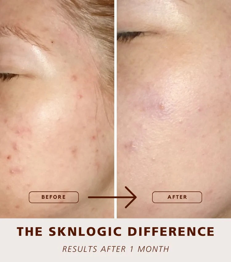SknLogic Clarify 75ml