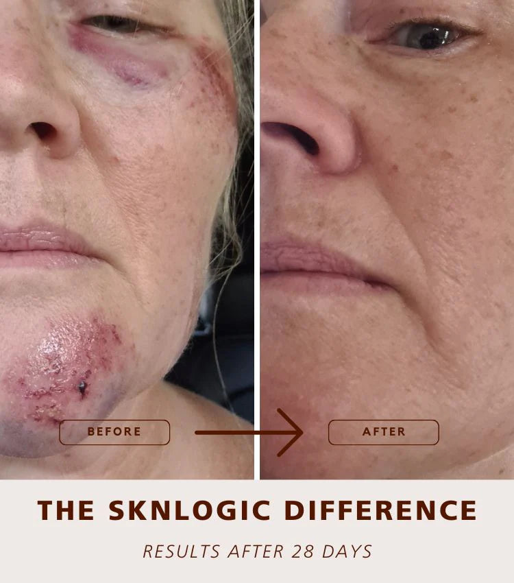 SknLogic Derma Repair Balm 50g