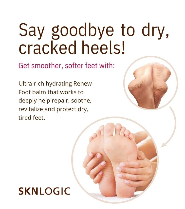 SknLogic Renew Foot Balm 75ml