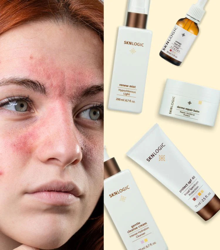 SknLogic Skin Rescue Essentials Kit